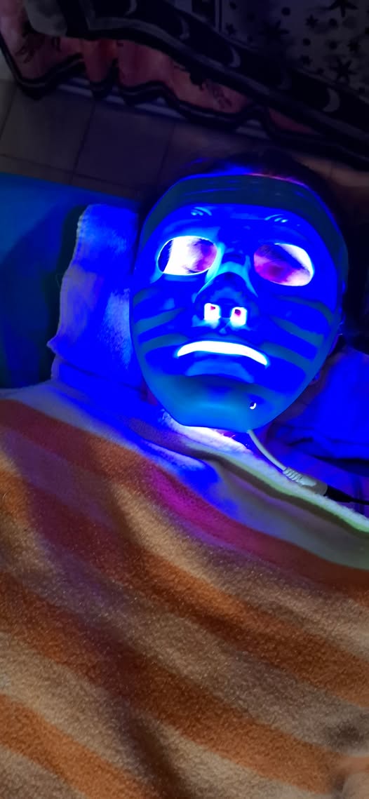 Aplicación de mascarilla facial con técnica de acupuntura